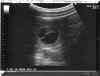 cherry ultrasound 4.29.08.jpg (305216 bytes)